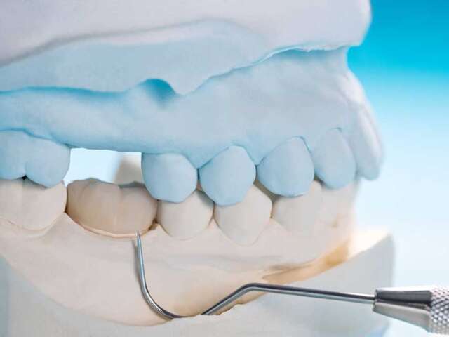 Tooth Implants Treatment Planning and Design