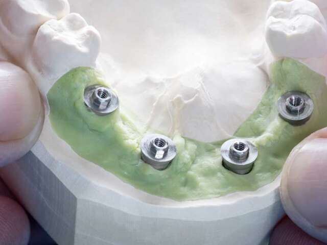 The Art and Science of Tooth Restoration