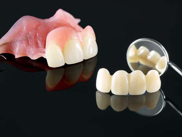 Expert Teeth Implant Dentistry