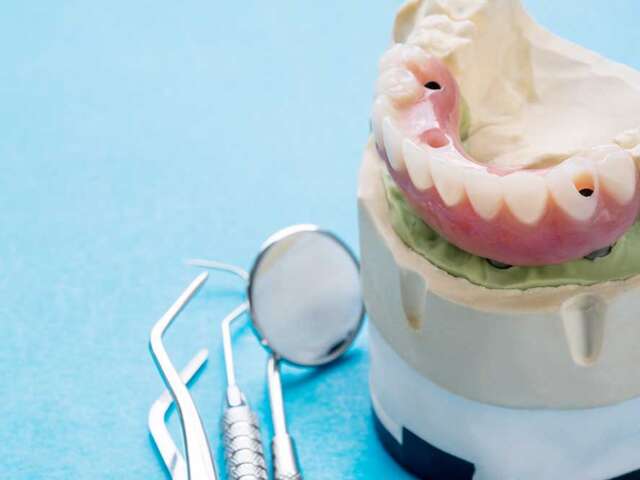 The Crucial Role of Implant-Bone Bond in Tooth Implants