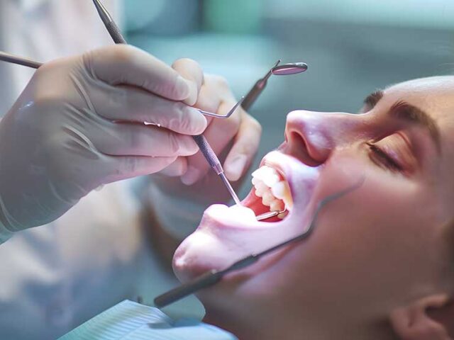 About Glass Ionomer Fillings